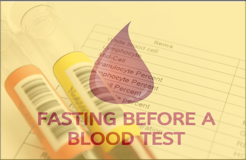 Is it necessary to fast before a blood test?