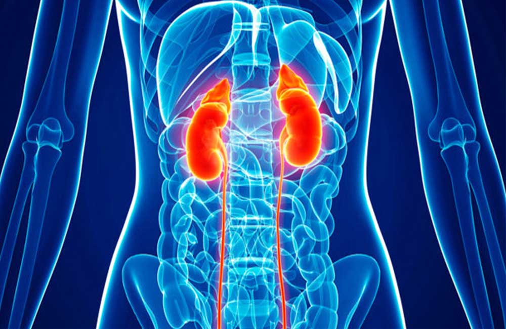 Kidney infection : Symptoms and causes